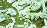 Lejyonella Pnömonisi Lejyoner Patojenleri (Legionellosis, Lejyoner Hastalığı) Lejyonella Pnömonisi Lejyoner Patojenleri (Legionellosis, Lejyoner Hastalığı)