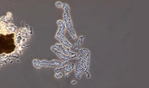 Aktif Çamur Sistemlerindeki EPS Oluşumu ve Viskoz Çamur Kabarması Arasındaki İlişki Aktif Çamur Sistemlerindeki EPS Oluşumu ve Viskoz Çamur Kabarması Arasındaki İlişki